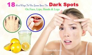 Easily Remove Dark Spots Lemon Juice 